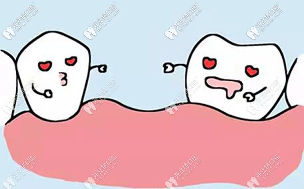 烤瓷和聚合瓷哪個更耐用