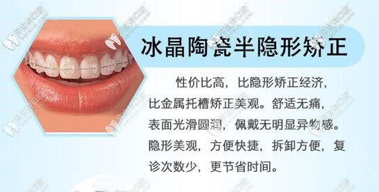093-陶瓷透明自鎖優(yōu)勢(shì)_副本.jpg