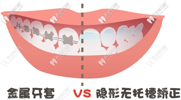 朔州的牙齒矯正參考價(jià)格
