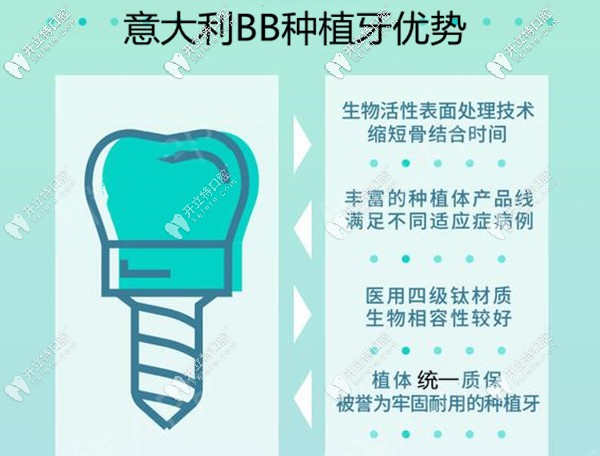 廈門(mén)麥芽口腔意大利BB種植牙優(yōu)勢(shì)