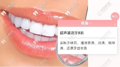 超聲波潔牙