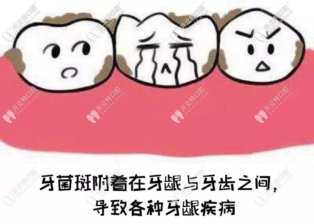 牙菌斑不清楚會出現(xiàn)各種牙齒疾病