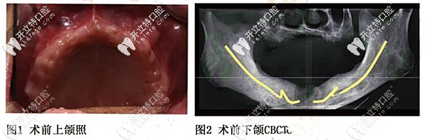 長春461醫(yī)院牙科收費價目表:種牙3980元/拔牙30元,電話預約快