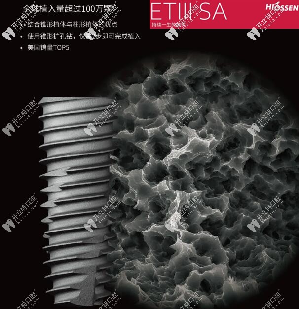 美國皓圣ETⅢ  SA種植體