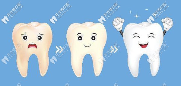 福州維樂牙齒美白優(yōu)惠