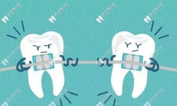 固德口腔戴矯正器的價(jià)格