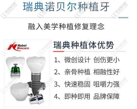 深圳勝健口腔瑞典諾貝爾種植牙優(yōu)勢(shì)