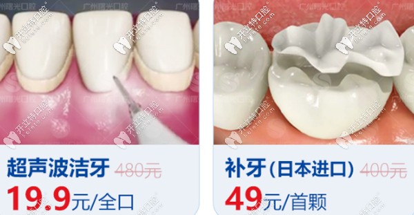 曙光口腔洗牙、補(bǔ)牙優(yōu)惠看這