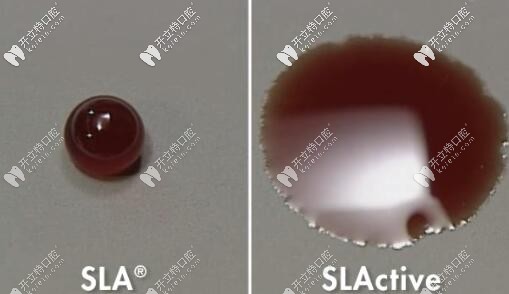 種植體表面處理技術