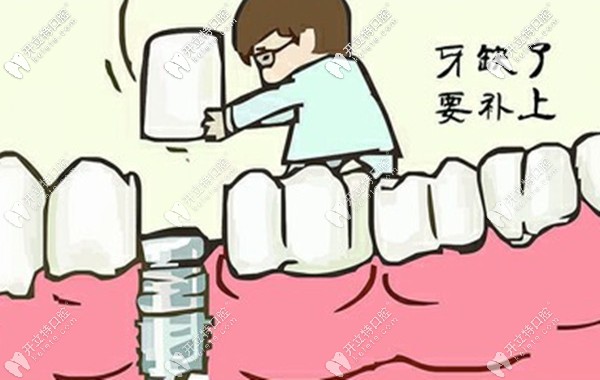 潮州地區(qū)種植牙大概多少錢一顆,韓系/歐美種牙系統(tǒng)價格全了