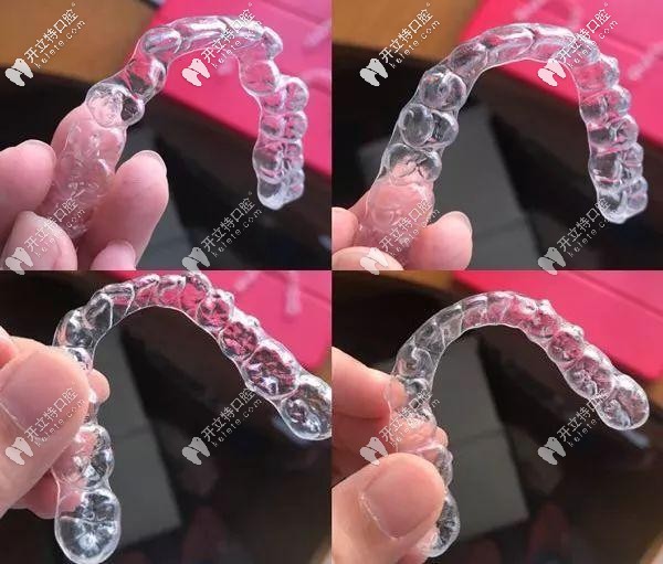 隱形牙套的外觀實(shí)拍圖