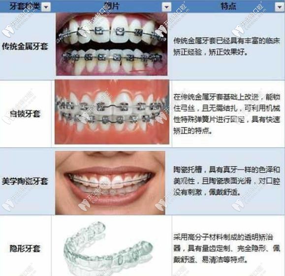 幾款常見(jiàn)牙套的優(yōu)劣勢(shì)對(duì)比