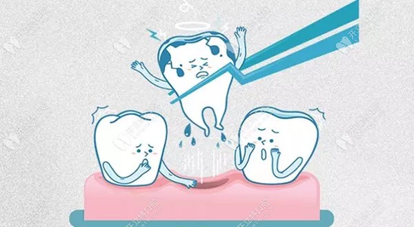 拔牙后留下的牙洞多久可以愈合,吃啥食物有利于盡快恢復