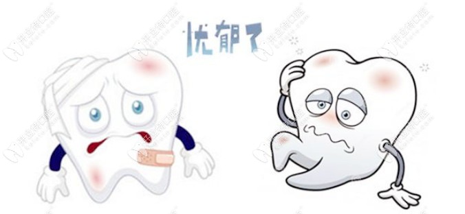 蛀洞太大補牙材料總掉該怎么辦？是時候了解長效補牙了