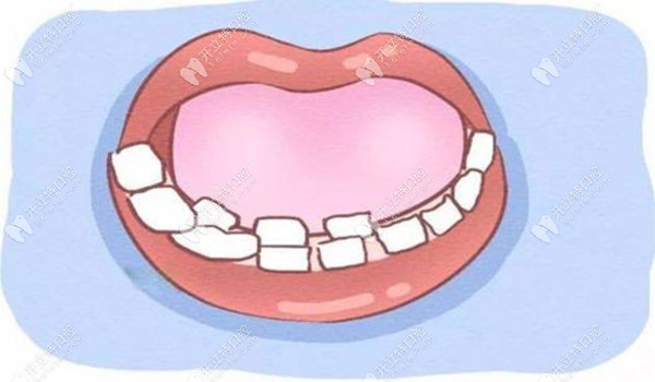 孩子長雙排牙是什么原因導致的呢?什么時候拔除比較好?