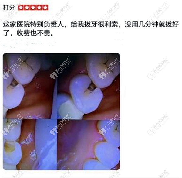 拔牙顧客評價(jià)藍(lán)天口腔