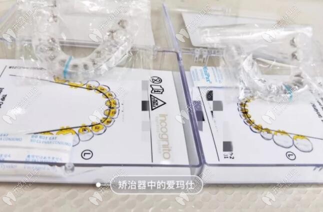 3m黃金incognito舌側(cè)隱形矯正價(jià)格一般是多少？講講它的優(yōu)缺點(diǎn)