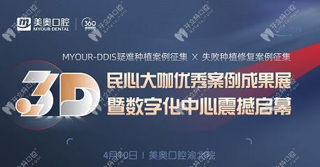 聽說美奧口腔做精準(zhǔn)種植牙還不受罪,這場案例直播不能錯過