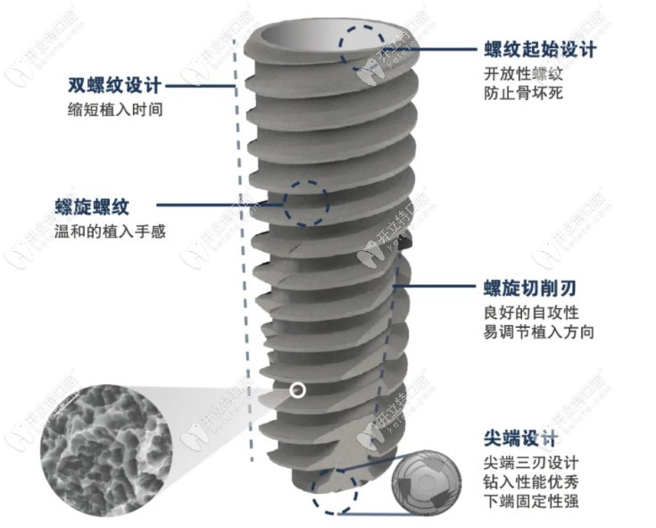 韓國奧齒泰ts3 SA植體怎么樣呢?據(jù)說很適合即拔即種即刻負(fù)重