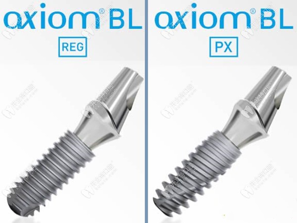 法國種植體不同型號價格