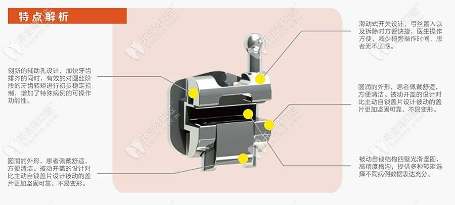 西湖巴爾自鎖托槽0元享