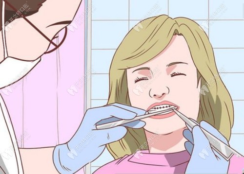 楊醫(yī)生粘托槽的時(shí)候十分認(rèn)真 楊醫(yī)生粘托槽的時(shí)候十分認(rèn)真