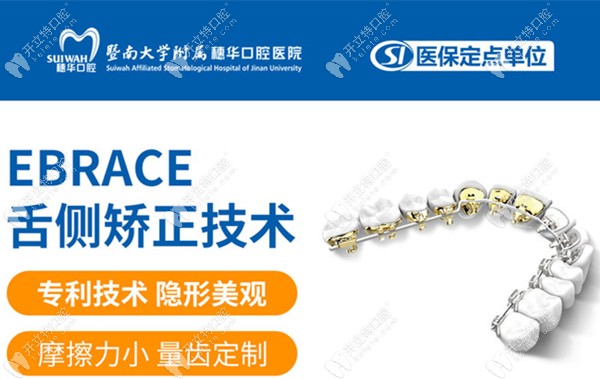 eBrace舌側(cè)隱形正畸的優(yōu)勢