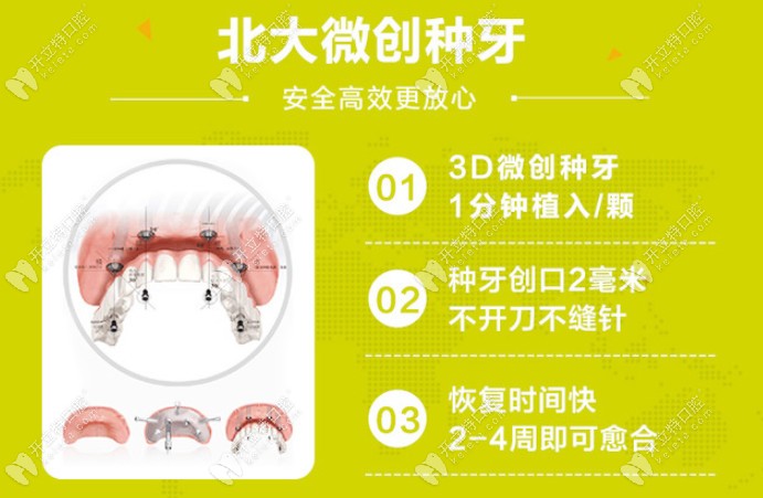 固德口腔種植牙優(yōu)勢