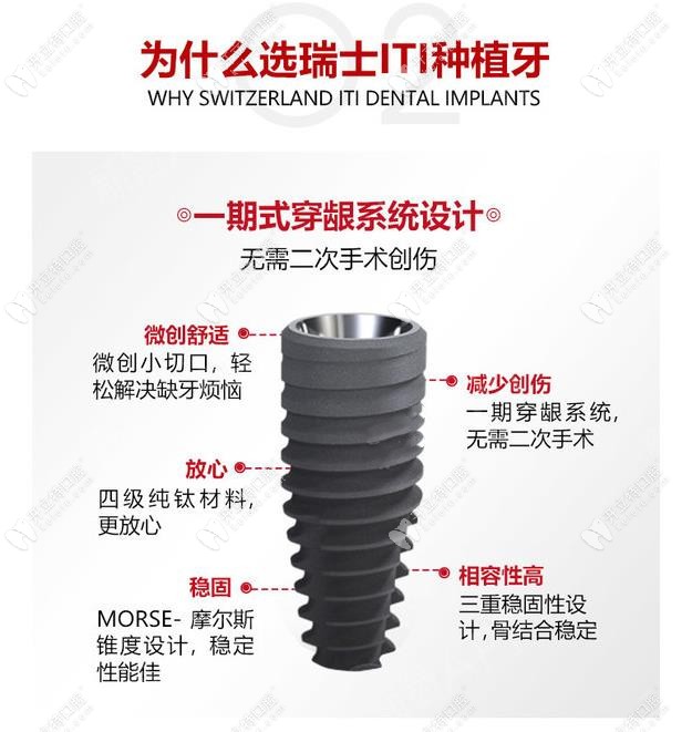 瑞士iti士卓曼種植體好嗎？