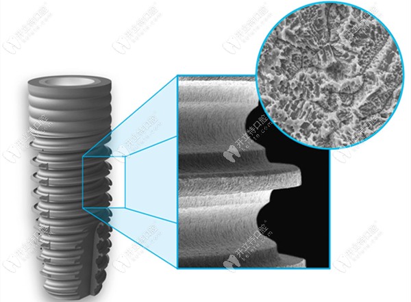 西傲種植體的細(xì)節(jié)展示