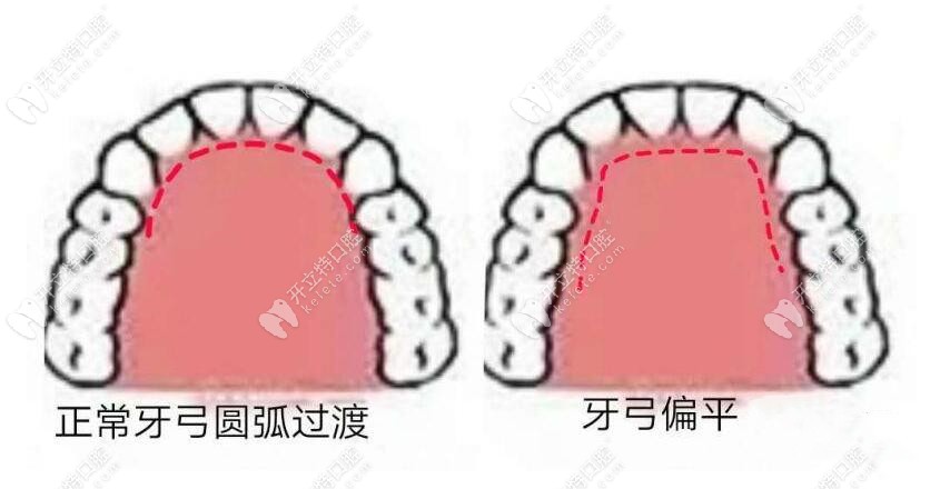 前牙牙弓修復(fù)形態(tài)